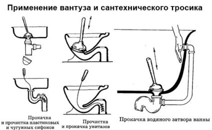 Как устранить засоры в кухонных раковинах?